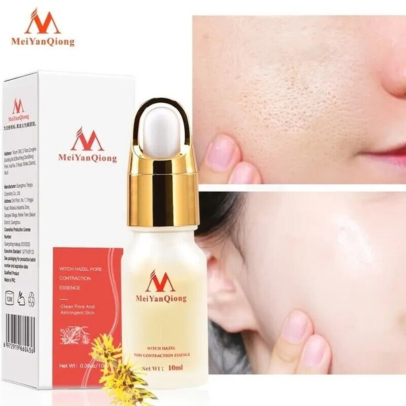 Meiyanqiong Witch Hazel Pore Essential Serum .34fl.oz. Shrink Clean Lighten Skin - Picture 3 of 5